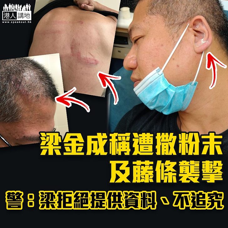 【譴責暴力】梁金成稱遭撒粉末及藤條襲擊 被警告「唔好再搞事」警:梁拒絕提供資料、不追究