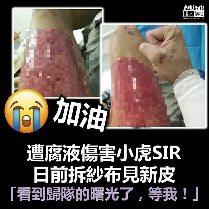 【早日康復】被腐液弄傷小虎SIR:看到歸隊的曙光了,等我!