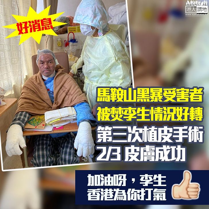 【為李生打氣!】葛珮帆:好消息!馬鞍山被焚李生情況好轉