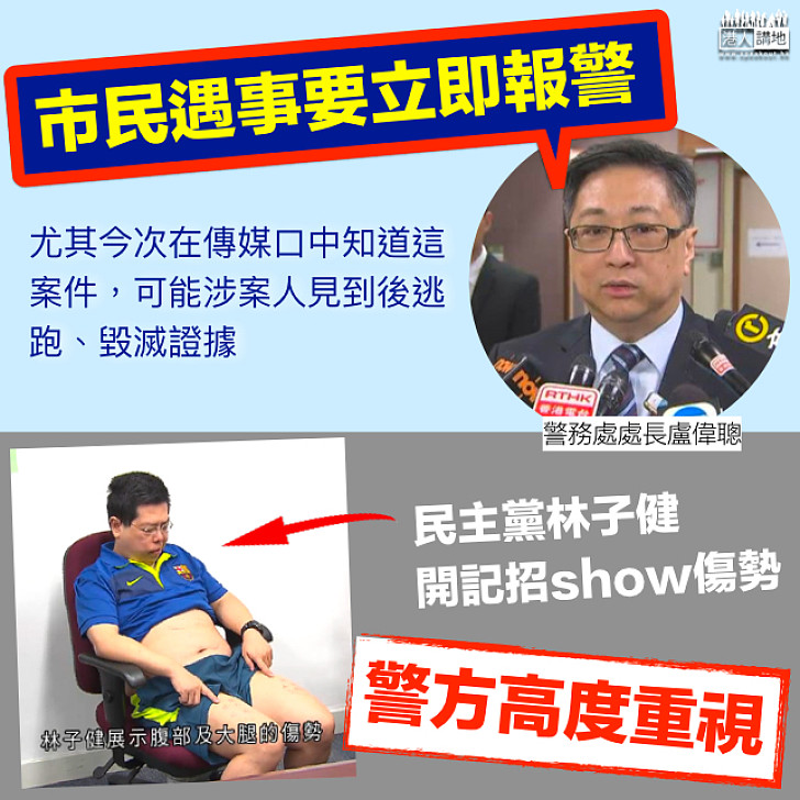 【高度關注】回應林子健遇襲 盧偉聰:市民遇事要立即報警